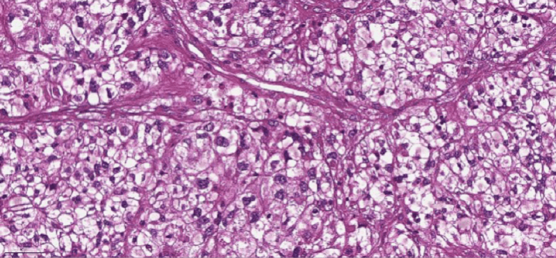 endo15