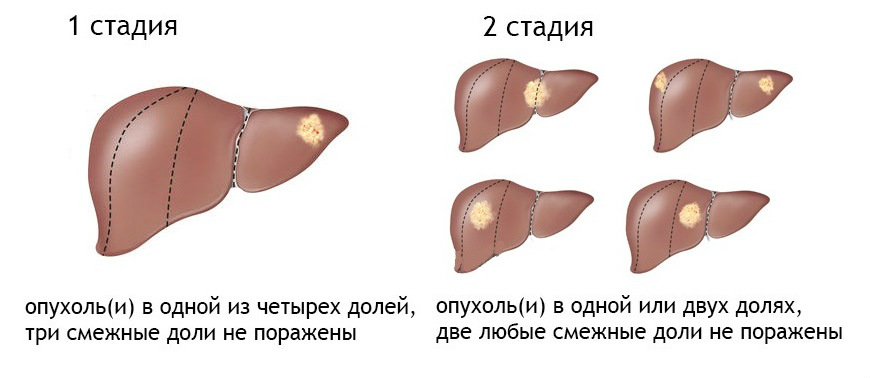 stpechen