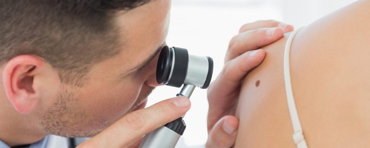 dermatoskopija