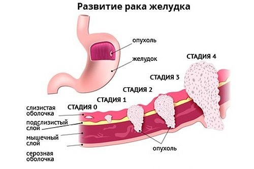 jeludok