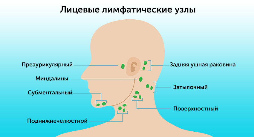 Рак миндалин