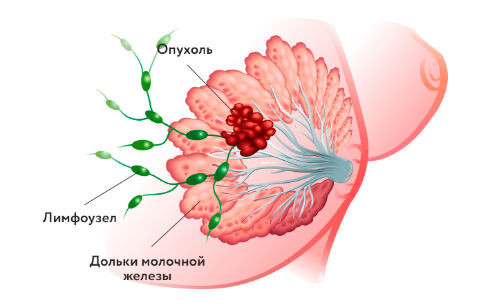 rak-pedzheta