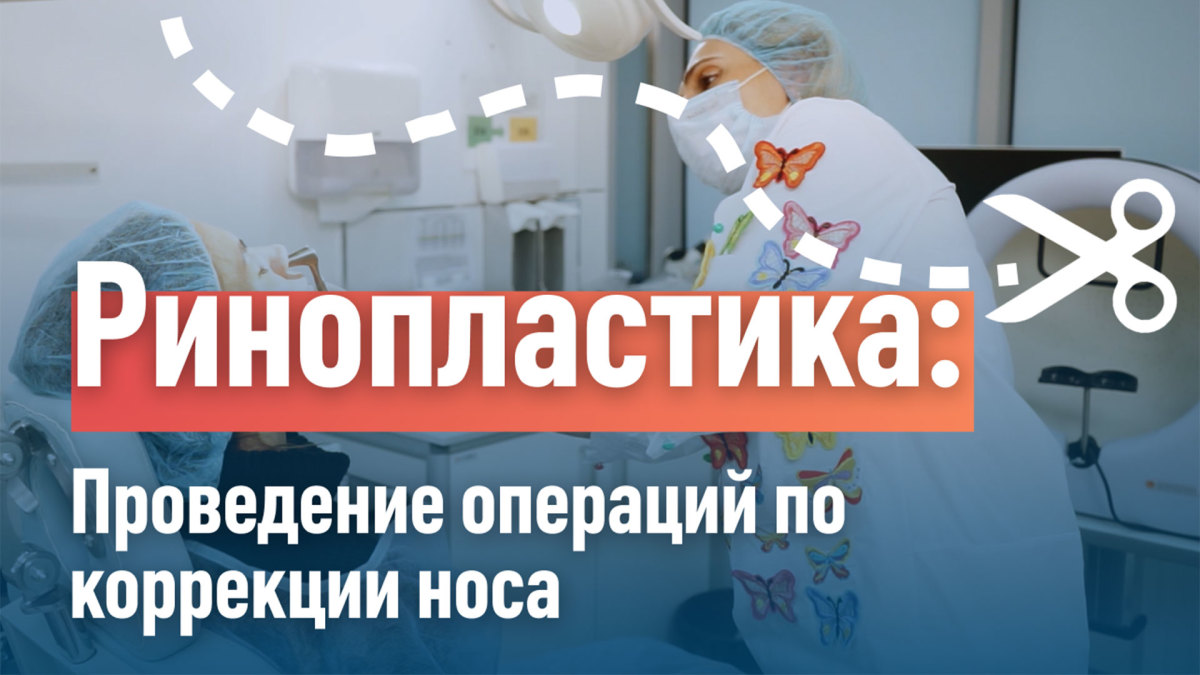 Ринопластика