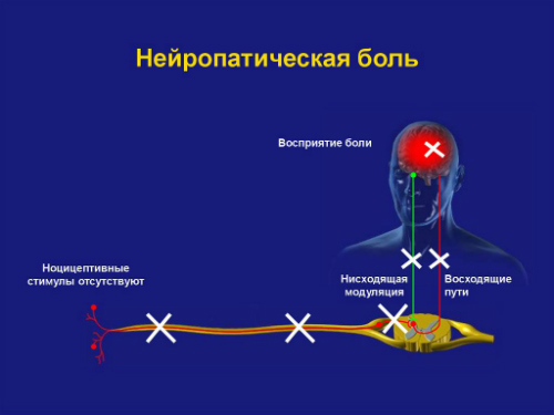 обезболивание1