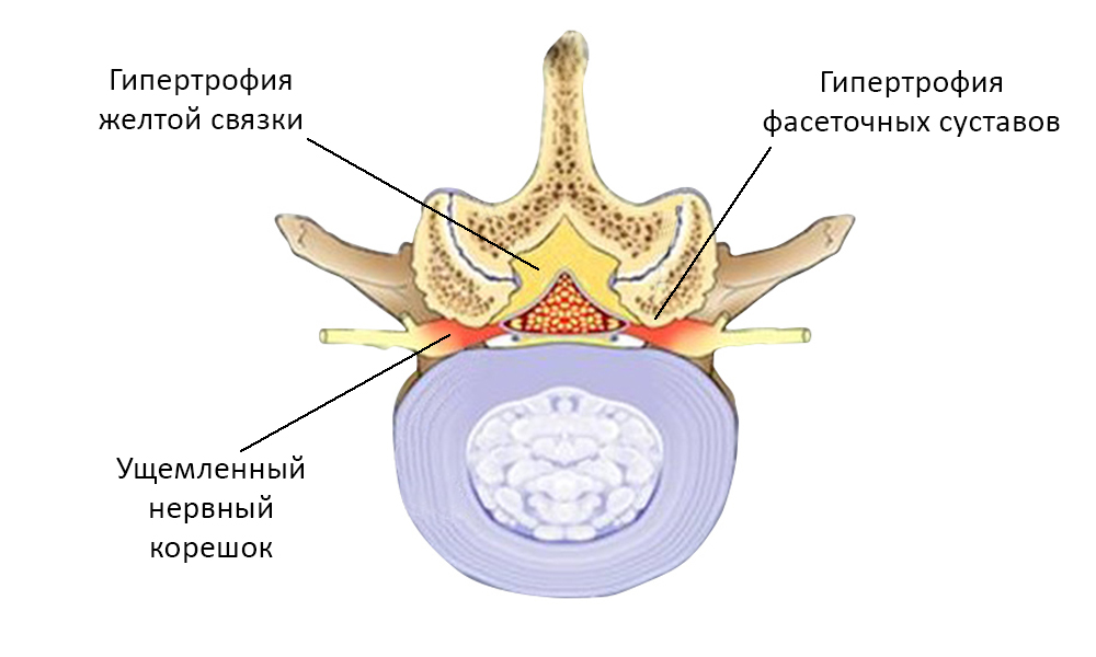 хабр8