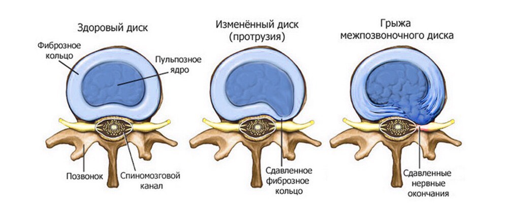 хабр7